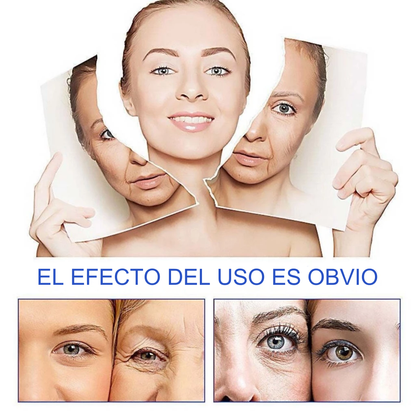 ESENCIA SERUM BOTOX